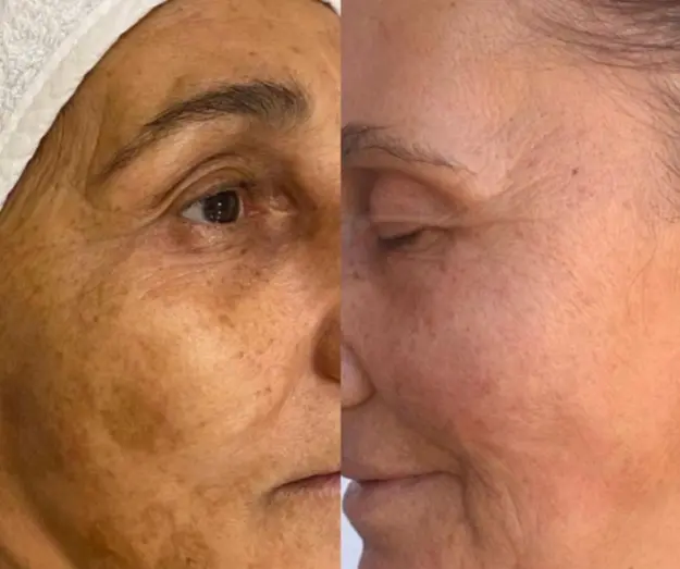 Ana Sayfa ejderha kani