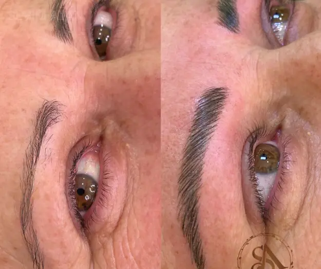 Ana Sayfa ka┼s laminasyonu